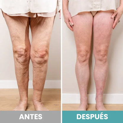 RelaxOn™ - Masajeador de Pies